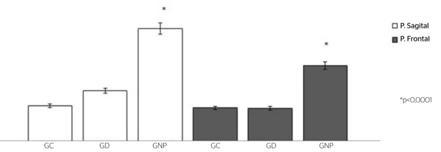 Figura 3. Valores em módulo da diferença das oscilações com e sem visão, obtidas no plano sagital e frontalGC: grupo controle; GD: grupo diabetes; GNP: grupo neuropatia diabética; P
