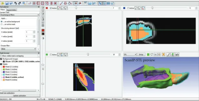 Figure 1: Tomographic image discretization for the creation of the virtual geometry model.