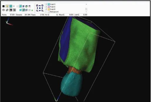Figure 2: Finite element mesh of the dentoalveolar articulation. Elements1 May 1 2010 12:01:06 Plot no