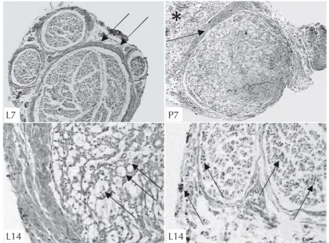 Figura 2    Morfologia dos grupos placebo e tratado: perineuro (setas) normal no