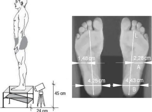 Figura 3     Ilustração do esquema para podoscopia (A) e medições para cálculo do