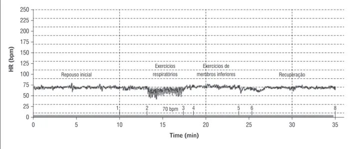 Gráfico 1  - Ilustração da aquisição da frequência cardíaca instantânea, obtida a partir da gravação dos intervalos R-R pelo  software do sistema Polar, durante a execução do primeiro dia do protocolo de fisioterapia cardiovascular fase I  de um dos pacien