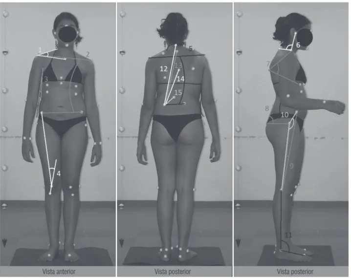Figura 1  - Ângulos utilizados na avaliação postural 