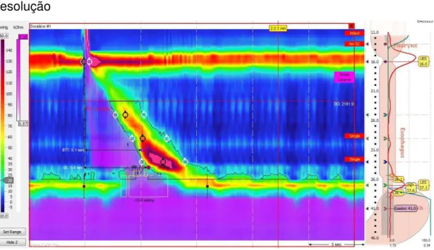 FIGURA  6  -  Imagem  de  topografia  de  pressões  à  manometria  de  alta  resolução 