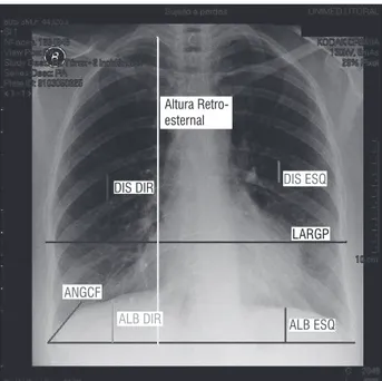 Figura 1 - Imagem das medidas analisadas na radiografia