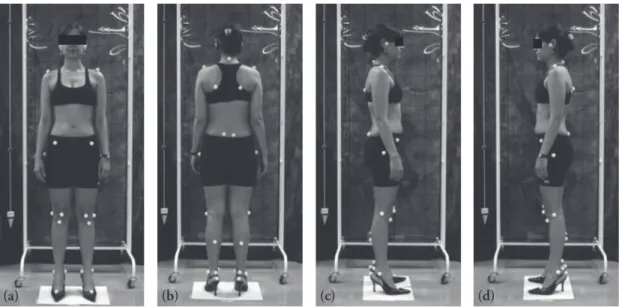 Figura 1 - Análise postural estática com o programa SAPO - (a) vista anterior, (b) vista posterior,  (c) vista lateral direita e (d) vista lateral esquerda