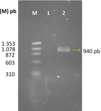 Figura  7  –   Eletroforese  em  gel  de  agarose  1%  dos  produtos  de  amplificação  da  ORF  CV2736 PS+   por  PCR,  a  partir  de  DNA  genômico  de  C