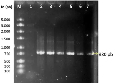 Figura  11  - Eletroforese  em  gel  de  agarose  1%  dos  produtos  de  PCR  utilizando  DNA  genômico  de  clones  de  P.pastoris  KM71H,  transformados  com  o  vetor  pPICZαAμμCV2736 PS  