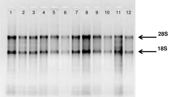 Figura 1A-   Eletroforese  em  gel  de  agarose  a  1,2%  demonstram  a  qualidade  de  RNA total das amostras