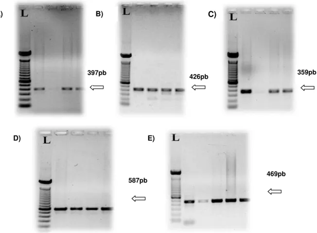 Figura 3-  Eletroforese em gel de agarose 1,0% dos diferentes produtos de PCR  do gene AIP