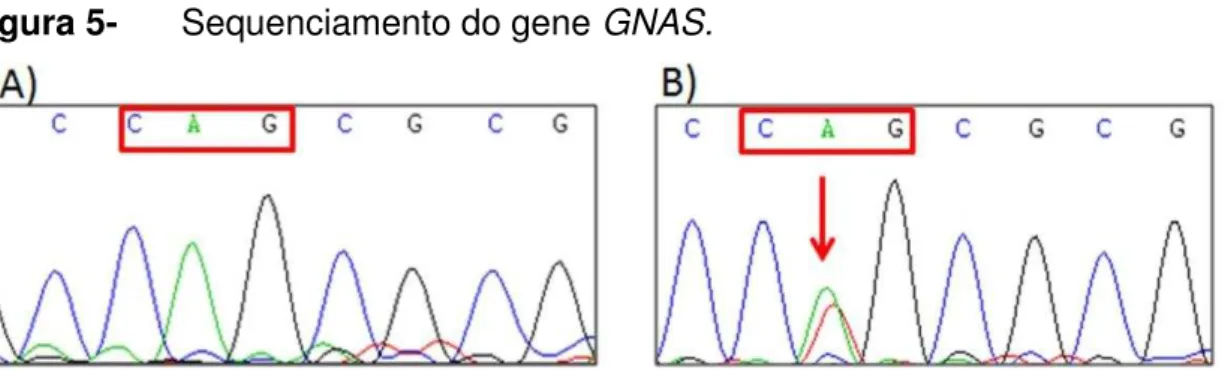 Figura 5-   Sequenciamento do gene GNAS. 