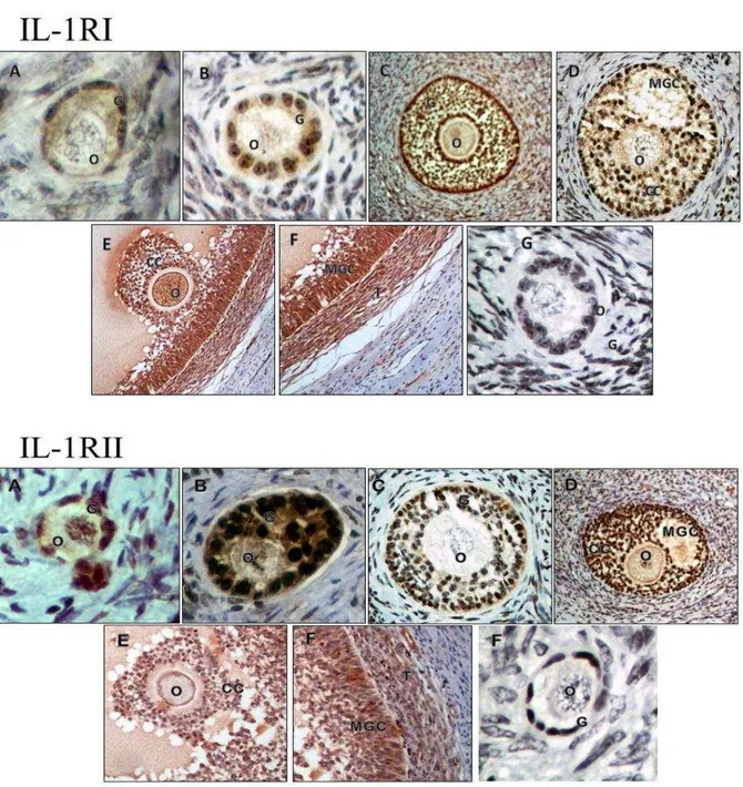 Figure  2A-G.  Interleukin  1-RI  and  IL-1RII  immunoreactivity  in  different  follicular  categories