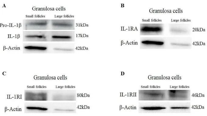 Figure  3A-E.  Protein  expression  for  members  interleukin  I  system:  IL-1β  and  its  precursor  Pro-IL-1  β,  IL-1RA,  IL-1RI,  IL-1RII  determined  by  Western  blotting