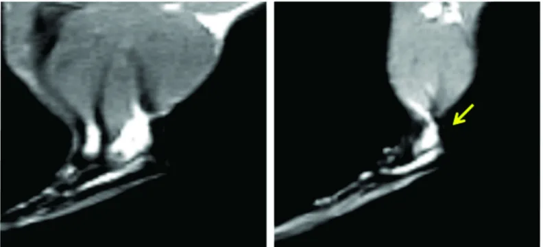 Fig 2. Detail of Sagittal Spin Echo image—T1 weighted of 7T MR images. A—Tendon of the Control Group; B—Tendon of the Diabetic Group showing increased area when compared to the control, in view of the weight