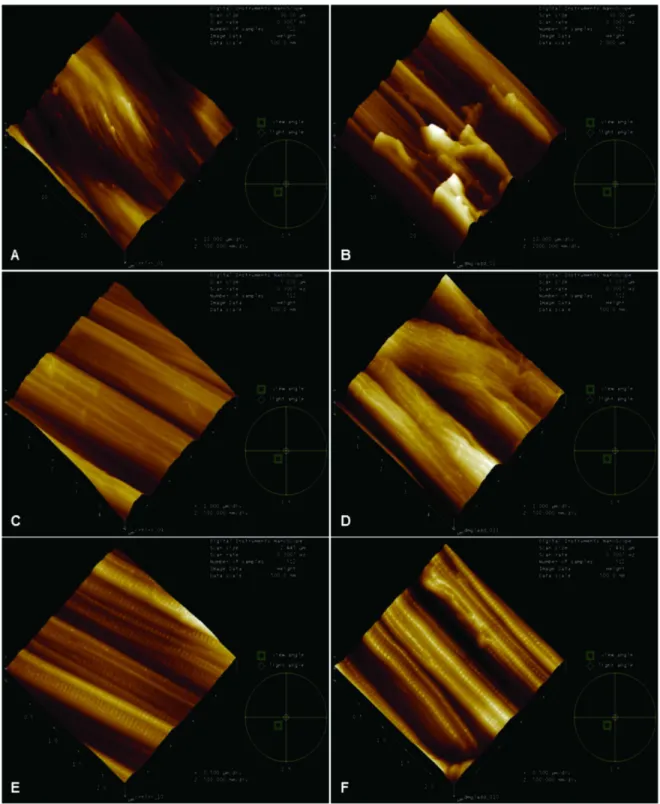 Fig 3. Characterization of surface roughness using Atomic Force Microscopy. 3D representation of the topography of the surface of the fibers and fibrils of the Control Group (A, C and E) and the Diabetic Group (B, D and F) with an area of 30 μm, 5 μm and 2
