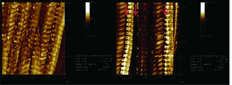 Fig 5. Phase image of surface topography of the fibrils. A—Control Group and B—Diabetic Group, presenting changes in the interfibril space, where the proteoglycans, GAG chains and the covalent bonds (cross links) are located, the phase angle (dark) was ind