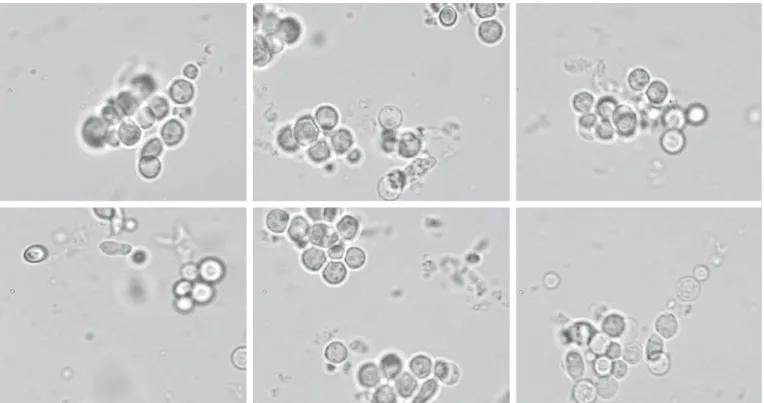 Figura  2.   Protoplastos  obtidos  a  partir  de  células  de  Saccharomyces  cerevisiae  KL-88  após  ação  da  β-1,3  glucanase  purificada  da  linhagem 
