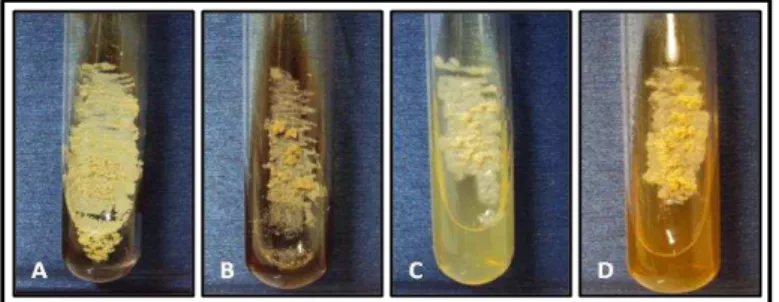 Figura 7. Aspecto macroscópico de H. capsulatum na fase de levedura, após 15 dias de incubação a 35 °C  em  diferentes  meios  de  cultura,  evidenciando  colônias  de  textura  cremosa,  de  cor  bege,  com  superfície  lisa ou rugosa