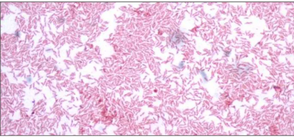 Figura 6: Foto da coloração de Gram de Campylobacter coli  INCQS 00263 cultivado no Laboratório de Doenças Infecciosas,  UPC-IBIMED/UFC 