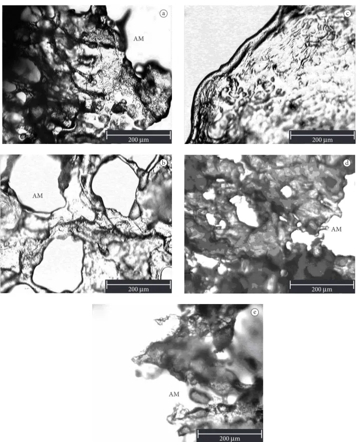Figura 8.  Fotomicrografias, em microscópio fotônico, dos tratamentos sem adição de açúcares dos pós obtidos da polpa de pequi liofilizada,  adicionados de: a) 0% de álcool; b) 5% de etanol; c) 10% de etanol; d) 5% de isopropanol; e e) 10% isopropanol