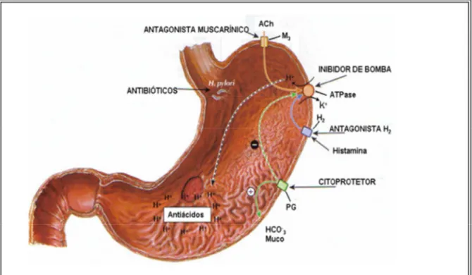 Figura 2. Terapêutica da úlcera péptica (Adaptado de Ralfa; Rawis; Beyzarov, 2006).