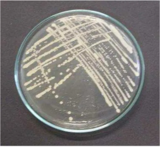 Figura 6 – Saccharomyces cerevisiae cultivada em meio Ágar Sabouraud Dextrose. 