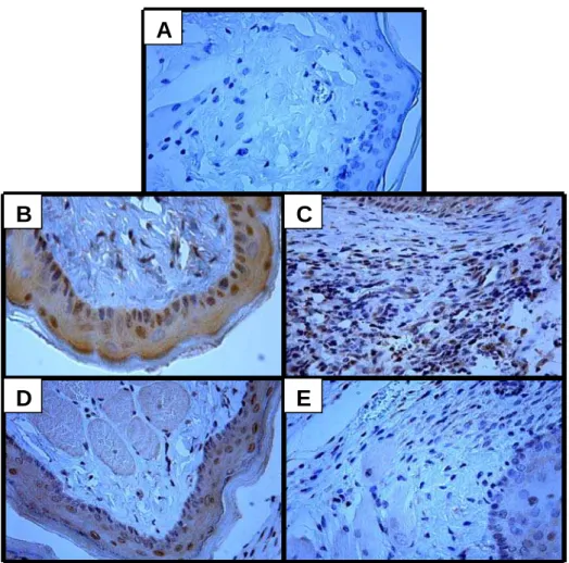 Figura  10 - Fotomicrografias de imunohistoquímica para NOSi de uma mucosa jugal  normal (B) ou com mucosite oral experimental recebendo solução salina (C),  aminoguanidina (AG; D), ou N-(3-(Aminomethyl)benzyl)acetamidina (1400W; E)