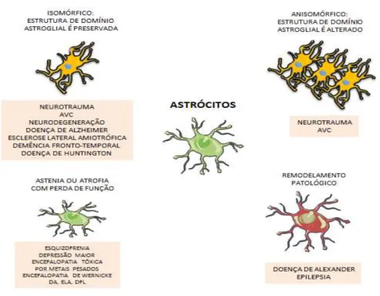 FIGURA  4.  Patologia  astroglial.  Astrócitos  sofrem  alterações  morfo-funcionais  em  patologias  cerebrais (ver texto para detalhes)