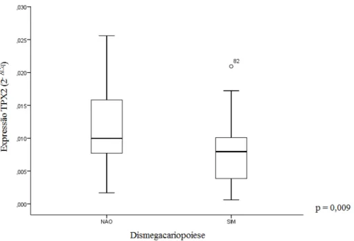 Figura 10: Níveis de expressão do gene  TPX2  em pacientes com SMD em relação a presença  de dismegacariopoiese na MO