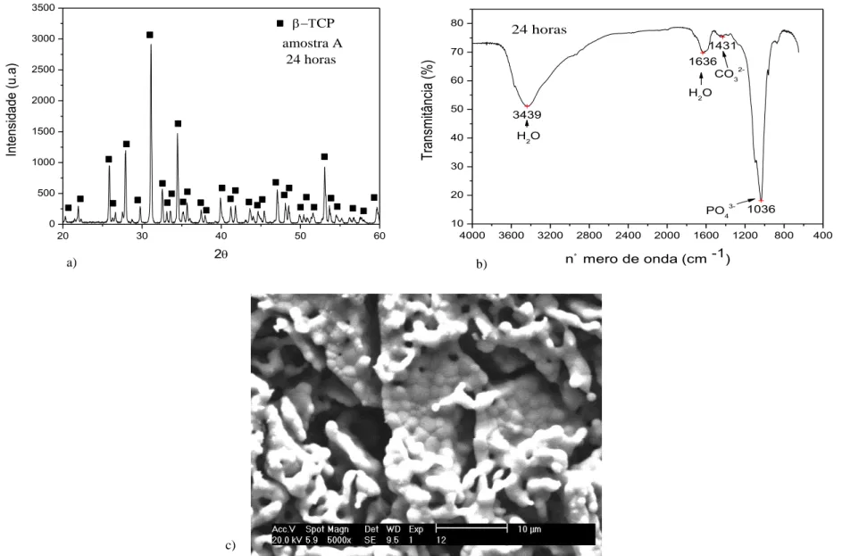 Figure 1  –  a) X- ray diffraction, b) FTIR    and c) morphological analysis by MEV of β -TCP nanoparticles sintered at 1200 °C.