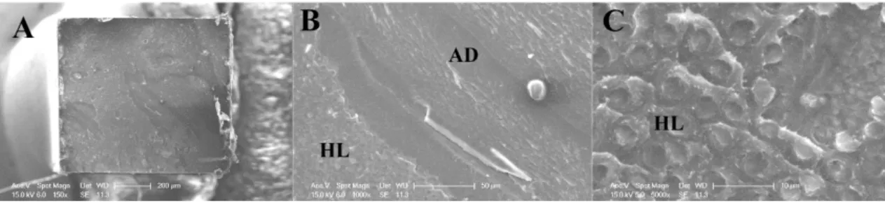 Figure 3 - The 24 h SEM images of  β TCP-SB  group showed adhesive failures; A), B) and C) Showed  adhesive on fractured surface of adhesive