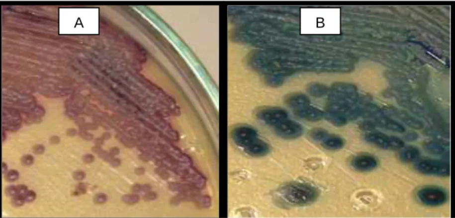 Figura  9  -  Placas  de  CHROMagar  Candida ®:  A  –   Candida  sp.,  necessários  testes  adicionais  para  a  identificação da espécie; B – Candida albicans em verde