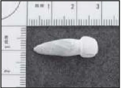 Fig. A1 - Vista vestibular do dente esculpido em concha . 