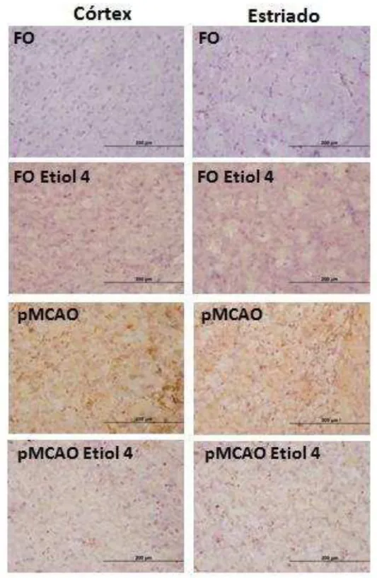 Figura 23. Fotomicrografia (40x) da imunoreatividade de TNF-α no córtex temporal e corpo  estriado  de  camundongos  submetidos  à  pMCAO  e  tratados  com  eriodictiol  na  dose  de  4  mg/kg, (n=4/grupo)
