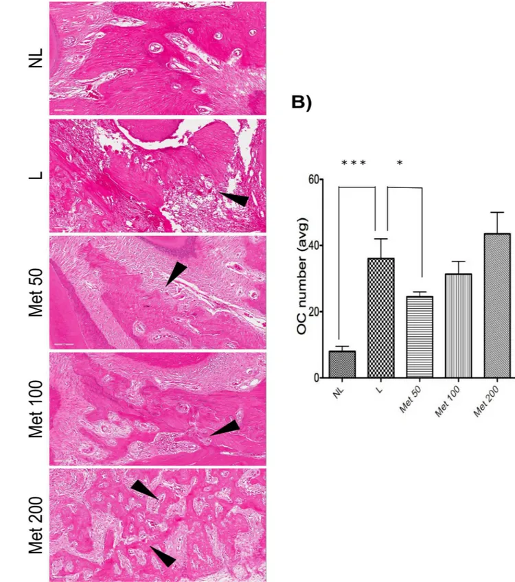 Fig 3. Quantitation of osteoclast numbers after MET treatment and experimental periodontitis