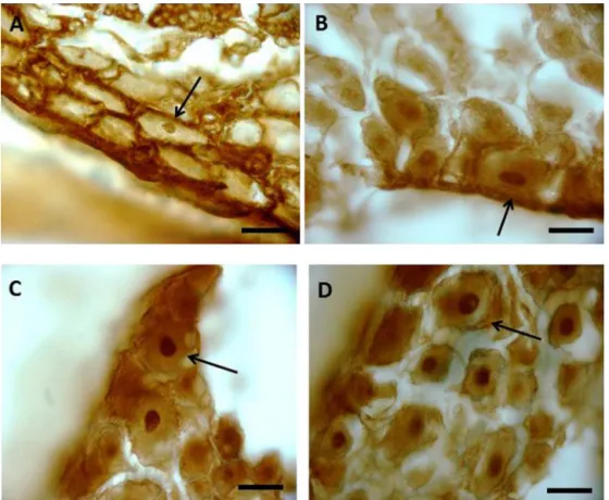 Fig. 4. ChAT-immunoreactive neurons. (A), saline group; (B), nerve group; (C and D), nerve + FGF-2 group
