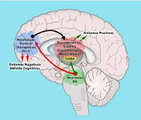 Figura 8: Representação hipotética associando a hipofunção cortical (redução da atividade de  receptores NMDA) e os sintomas da esquizofrenia