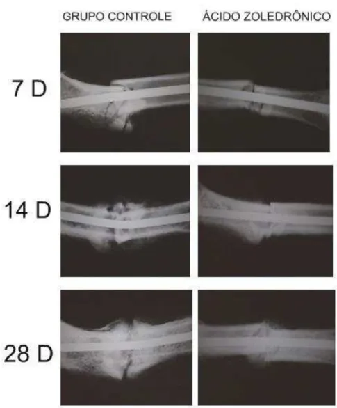 Figura 7 – Imagens radiográficas nos grupos, controle e ácido zoledrônico, nos tempos de  7, 14 e 28 dias de consolidação óssea 