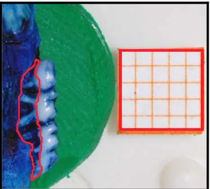 Figura  4:  Desenho  esquemático  da  mensuração  da  perda  óssea  alveolar  na  análise  macroscópica