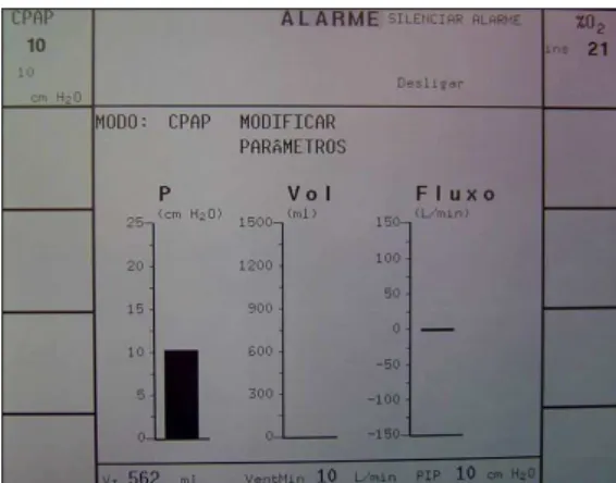 Figura 6 1 Registro das variações de fluxo, volume e pressão obtidos em CRF na tela do ventilador no momento do corte tomográfico com CPAP de 10 cmH 2 O, demonstrando a pressão estável sem variação de fluxo ou volume