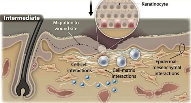 Figura  II.2.3:  A  fase  proliferativa  envolve  multiplicação  e  migração  de  fibroblastos,  queratinócitos,  deposição de componentes da MEC e angiogênese