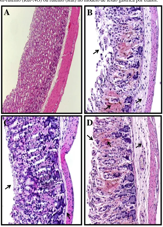 Figura 8 - Fotomicrografias da mucosa gástrica de camundongos tratados com salina,  nitrosil-rutênio (Rut-NO) ou rutênio (Rut) no modelo de lesão gástrica por etanol