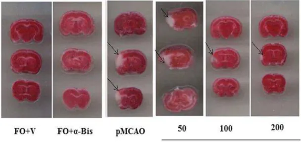 Figura  13. Visualização do dano neuronal isquêmico através da coloração de TTC entre os  grupos