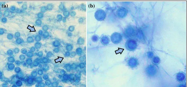 Figura 2  –  (a) Aspecto micromorfológico de H. capsulatum na fase filamentosa obtida em preparação de  lâmina-lamínula  com  lactofenol  azul-algodão