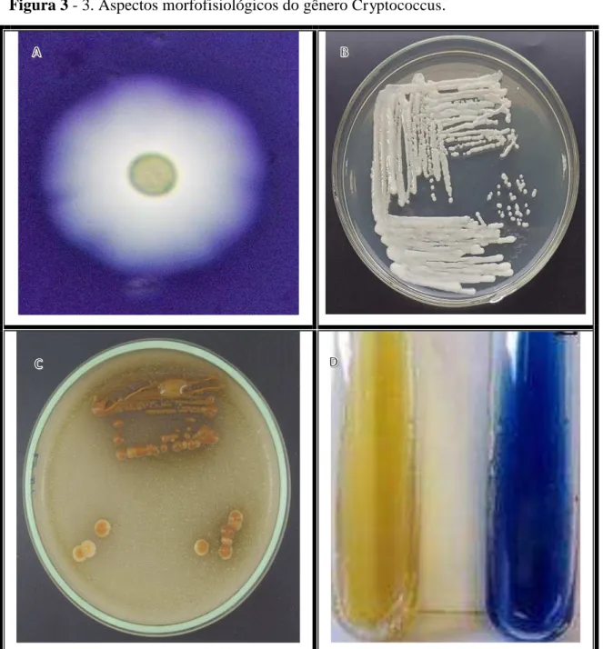 Figura 3 - 3. Aspectos morfofisiológicos do gênero  Cryptococcus . 