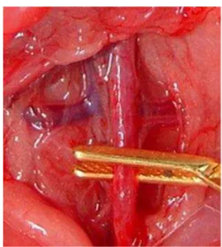 FIGURA  4  –  Identificação  e  isolamento da aorta infra-renal  sob  visão  direta  prestes  a  realizar  o  pinçamento