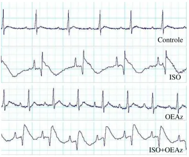 Figura  7  – Traçado  eletrocardiográfico  obtido  nos  grupos  Controle,  ISO,  OEAz  e  OEAz+ISO