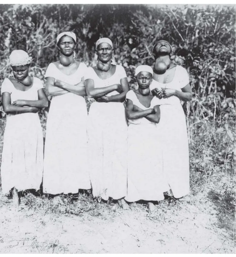 Figura 13: “A reprodução mostra a facilidade de se juntar um grupo de mulheres portadoras de grandes bócios