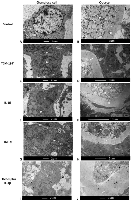 Figure 3. Representative micrographs of cultured secondary follicles from bovine after  18 days of culture in the presence of IL-1β, TNF-α alone or both