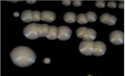 Figura 4. Aspecto macromorfológico de  Candida  spp., exibindo colônias de coloração branca,  superfície lisa e textura glabrosa úmida
